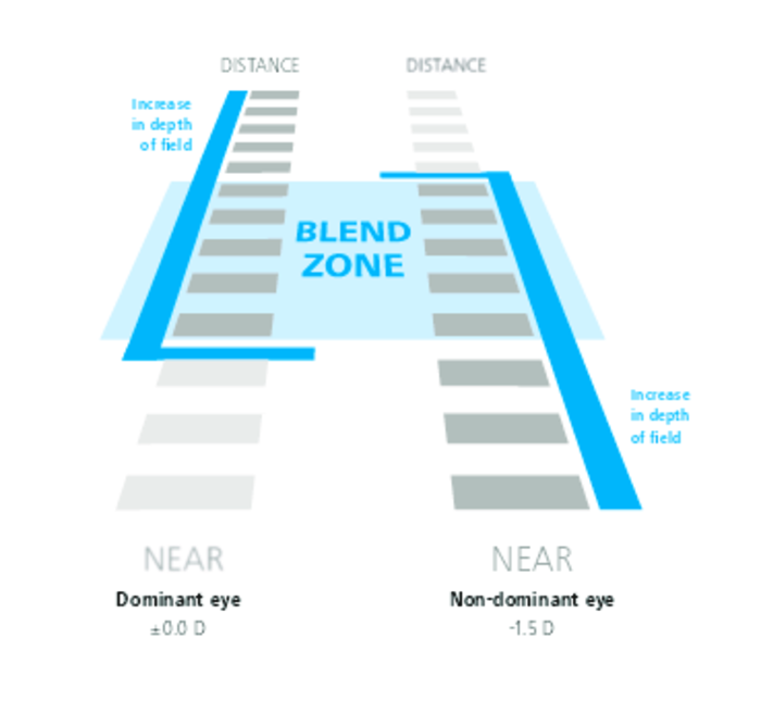 PRESBYOND_Blendzone (med-large)